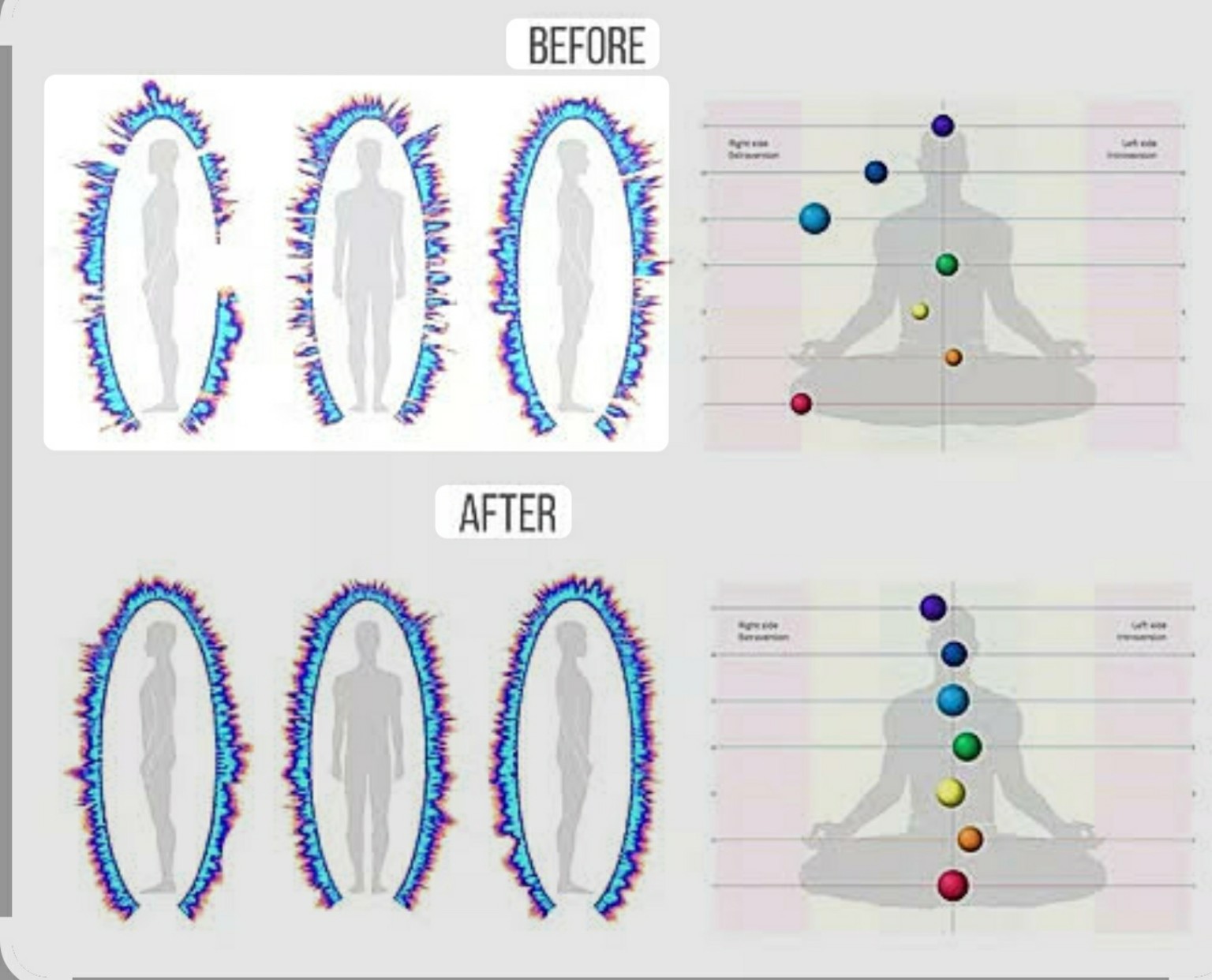 Before-and-after Bio-Well energy-field and chakra alignment comparison